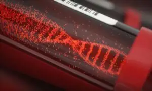 chromosome 15q13.3 microdeletion syndrome